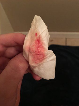 Bleed when losing virginity