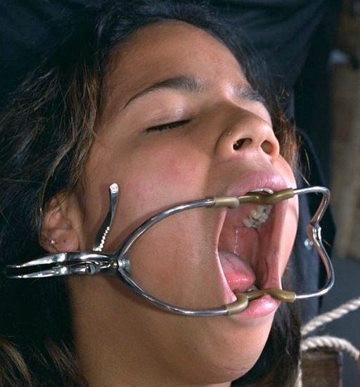 Bondage Dental Gag Porn Galleries