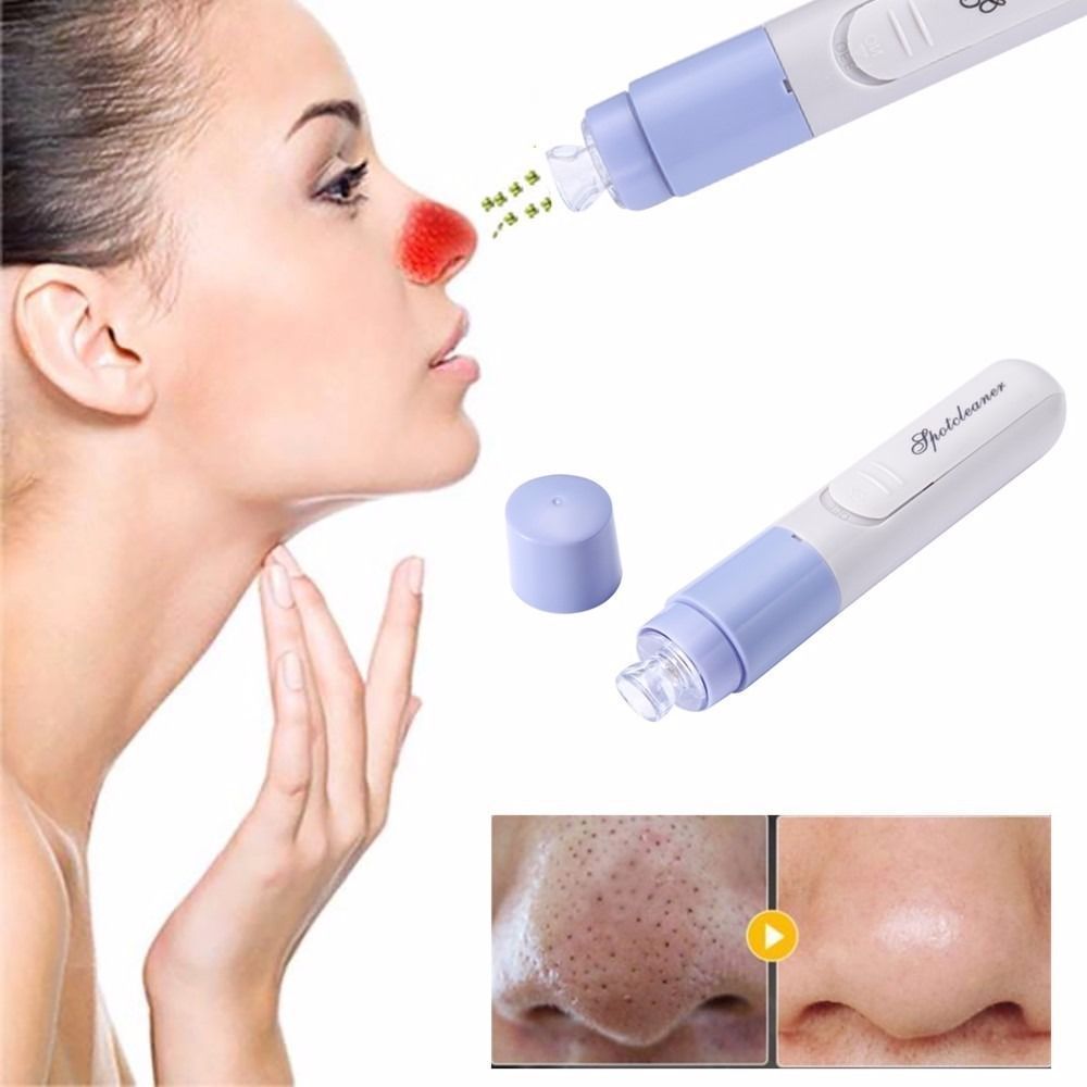 Adult acne treatments biore warming deep pore clea