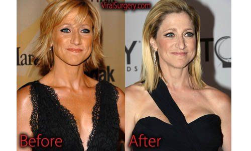 Boobs edie falco