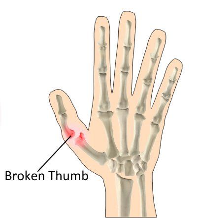 best of Thumb bones hand Right