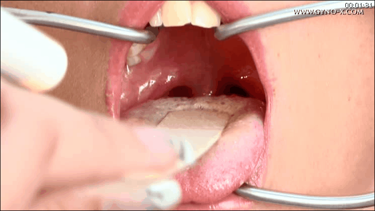 Dental fetish dentist